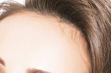 長沙美萊醫(yī)療美容醫(yī)院自體脂肪豐額頭