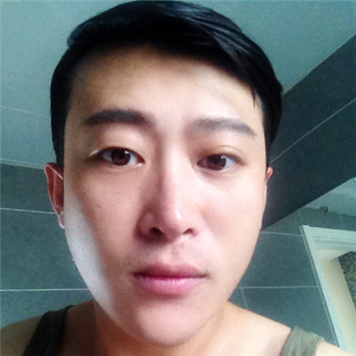 安陽(yáng)上城醫(yī)療整形醫(yī)生張少如打水光針效果怎么樣？附案例效果圖