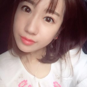 蚌埠韓美美萊整形做玻尿酸面部除皺效果怎么樣？附陳澤醫(yī)生案例效果圖