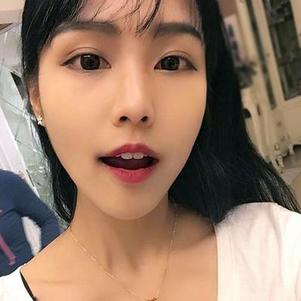 鞍山時代口腔門診部洗牙效果怎么樣？附申元休醫(yī)生洗牙案例效果圖