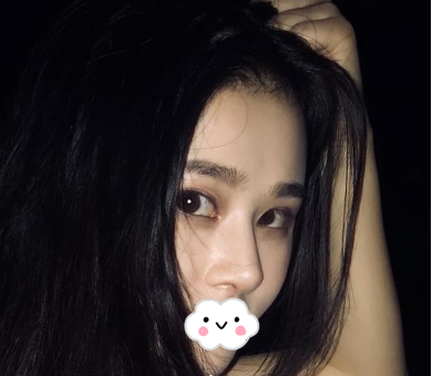 蚌埠韓美美萊整形醫(yī)生歷芳做耳軟骨隆鼻怎么樣？附耳軟骨隆鼻案例對比圖