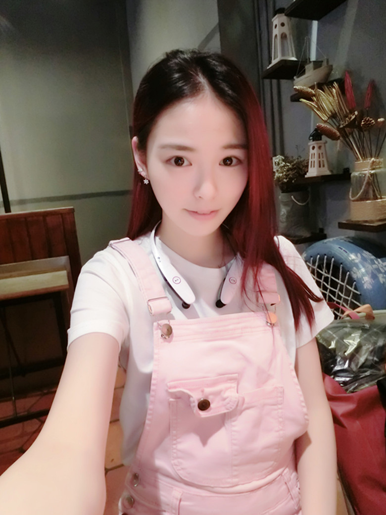 保定市第五醫(yī)院美容整形科做激光祛斑怎么樣？附單敬依醫(yī)生案例效果圖