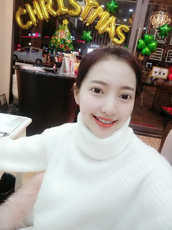 保定東陽口腔醫(yī)院溫興醫(yī)生做牙齒矯正怎么樣？附牙齒矯正案例效果對比圖