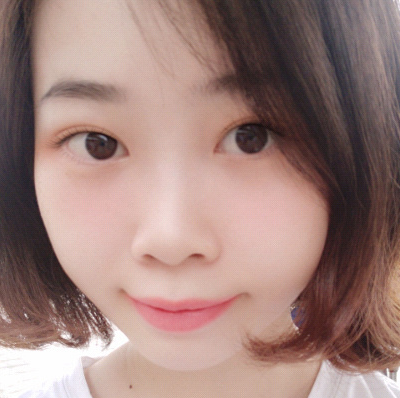 保定安卓貝拉醫(yī)療美容門診部孫大山醫(yī)生做雙眼皮+去眼袋怎么樣？附案例效果對(duì)比圖