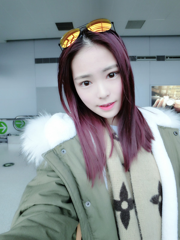 保定市第五醫(yī)院美容整形科做激光祛斑怎么樣？附單敬依醫(yī)生案例效果圖