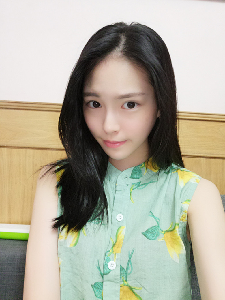 保定市第五醫(yī)院美容整形科做激光祛斑怎么樣？附單敬依醫(yī)生案例效果圖