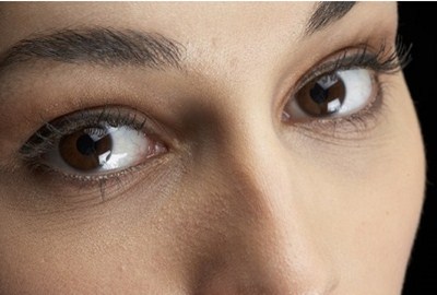 隆鼻假體能保持幾年？