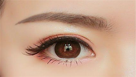 雙眼皮埋線是什么線？