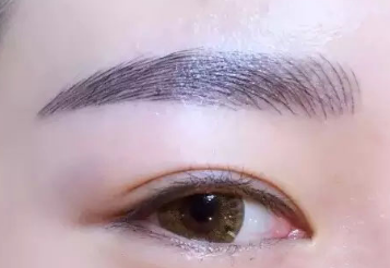 除皺去眼袋需要多少錢？價格貴嗎？