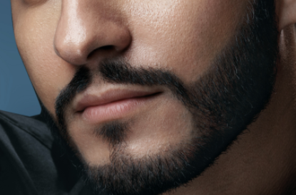 種植胡須后遺癥有哪些？