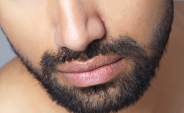 種植胡須大概多少錢？價錢貴嗎？