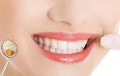 美容冠矯正是什么意思？