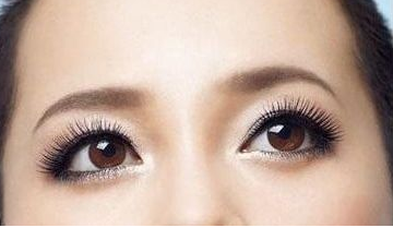 做完雙眼皮手術(shù)要忌口多長時(shí)間？