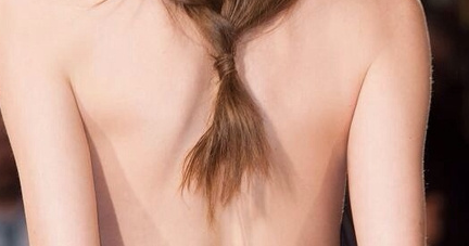 背部吸脂包括肩膀嗎？背部吸脂需要住院嗎？