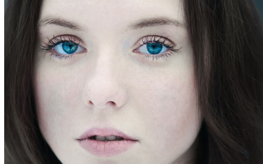 激光點痣留下的疤痕怎么辦？