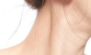 頸紋太深怎么辦?去除頸紋一般需要多少錢？