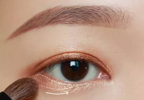 全切雙眼皮術(shù)后多久拆線？