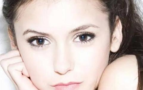 全切雙眼皮會留疤嗎？全切雙眼皮的優(yōu)勢有哪些？