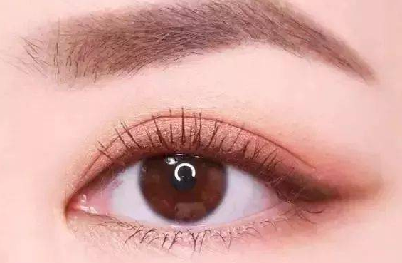 全切雙眼皮有什么副作用？