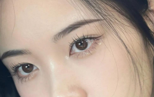 全切雙眼皮的特點(diǎn)有哪些？