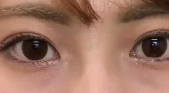 雙眼皮埋線后還可以開眼角嗎？做埋線雙眼皮有什么危險(xiǎn)？