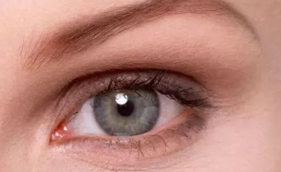 埋線雙眼皮能保持幾年？