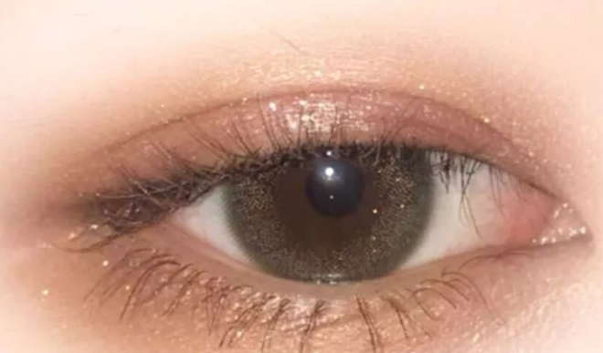 單眼皮割雙眼皮會留疤嗎？單眼皮割雙眼皮幾天恢復自然？