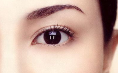 韓式開眼角多久恢復(fù)自然？韓式開眼角的特點(diǎn)有哪些？