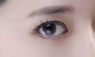 韓式開眼角的手術(shù)費(fèi)用是多少？