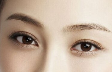 韓式開(kāi)眼角手術(shù)的恢復(fù)時(shí)間？