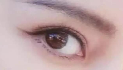 開內(nèi)眼角會讓你眼睛變大嗎？