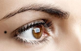 開(kāi)內(nèi)外眼角疼嗎？開(kāi)內(nèi)外眼角手術(shù)有什么風(fēng)險(xiǎn)？