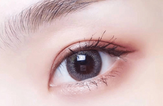 開(kāi)內(nèi)眼角大概需要多久恢復(fù)？