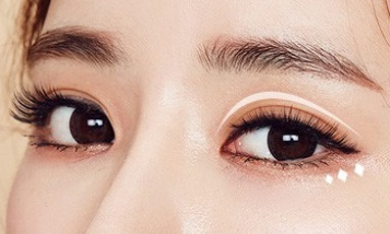 開眼角的風(fēng)險有多大？