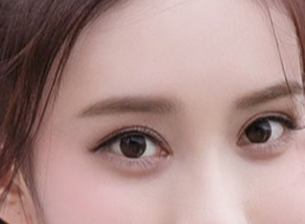 開眼角一般需要多少錢？