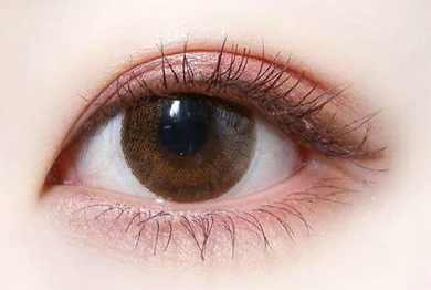 開(kāi)眼角術(shù)后多久才能恢復(fù)？