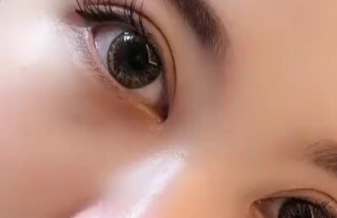 開眼角手術有什么別的方法？