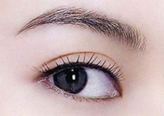 開眼角手術(shù)腫嗎？