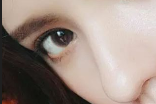 開眼角發(fā)紅怎么辦？