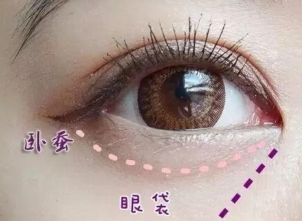 激光消除眼袋怎么樣？激光溶脂去眼袋多少錢？