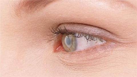 哪個(gè)開(kāi)眼角整形好？2022全國(guó)開(kāi)眼角整形醫(yī)院排名前十