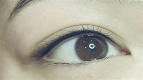 開眼角哪個(gè)醫(yī)院做的好？2022開眼角醫(yī)院排名前十