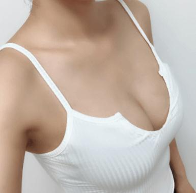 自體隆胸整形醫(yī)院哪家好？2022全國比較權(quán)威的隆胸醫(yī)院排名