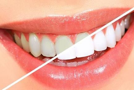 杭州牙齒種植整形醫(yī)院哪家好？2022排行榜前六實(shí)力強(qiáng)大！