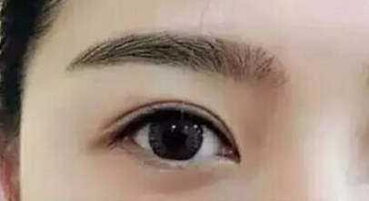 廣州眼部整形哪里好？這幾家醫(yī)院真不錯(cuò)！