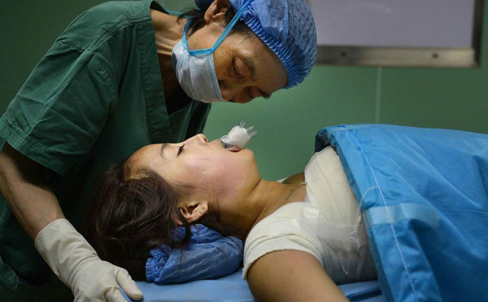 假體隆胸效果自然嗎？能維持多久？