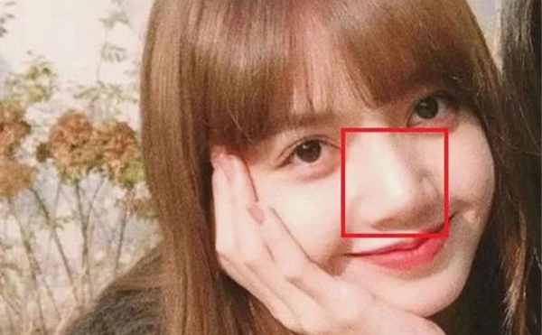 鼻子太大怎么辦？怎么改善大鼻頭