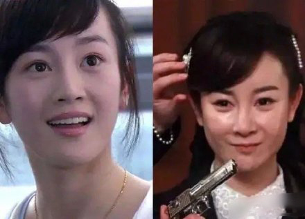 張檬整容失敗