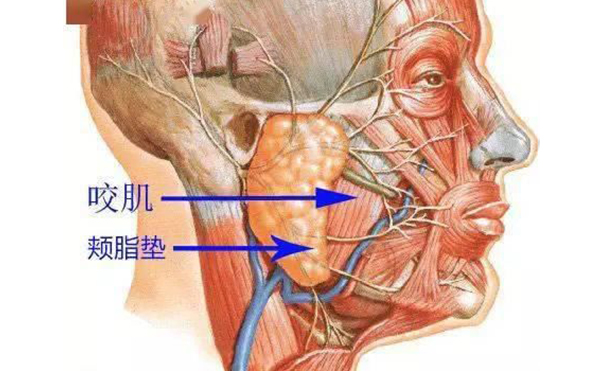 面部吸脂和取頰脂墊有什么區(qū)別?哪個(gè)效果好?