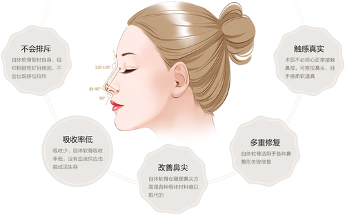 自體軟骨隆鼻可以永久的嗎？